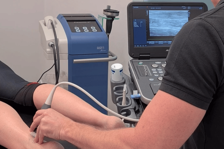 Ultrasound Guided Shockwave with The Performance Physio